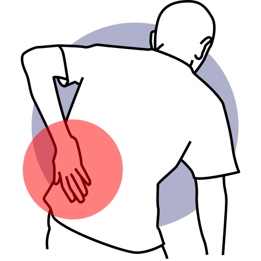 Painful Sciatica