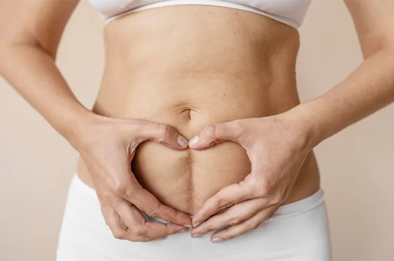 Diastasis recti treatment for core strength at Sport-Fit Physio Care Chennai