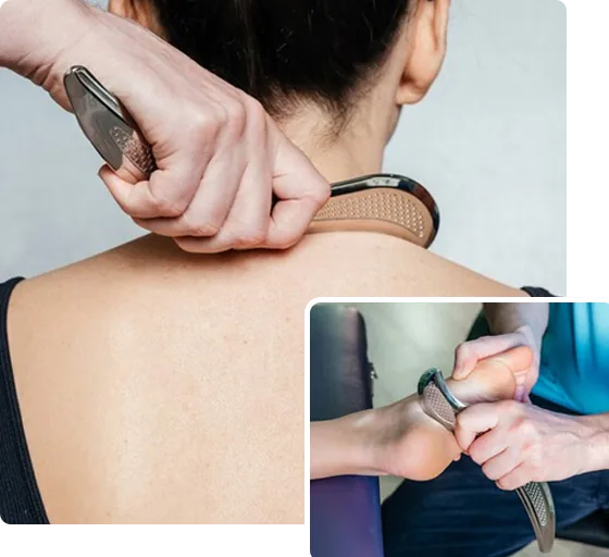 IASTM Treatment
